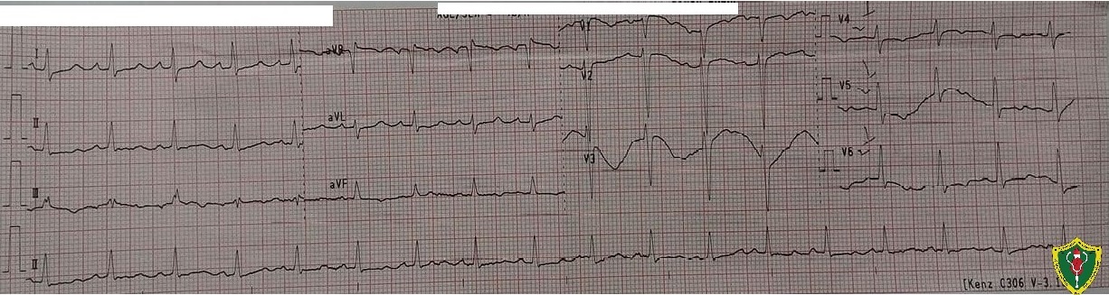 CotM April 2021 12L ECG