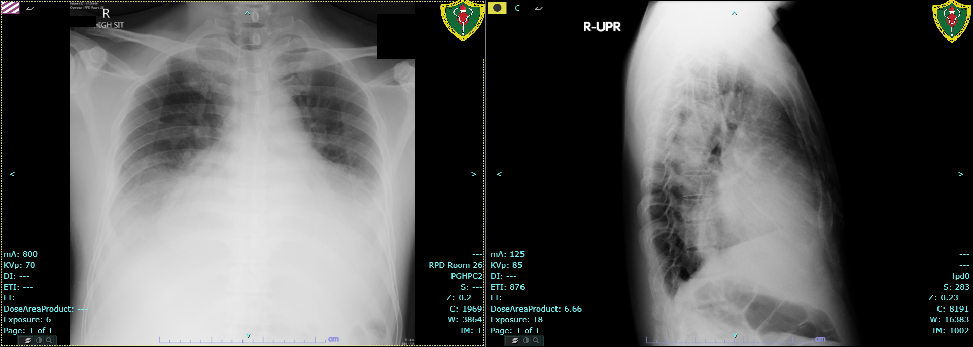 CotM April 2021 chest xray